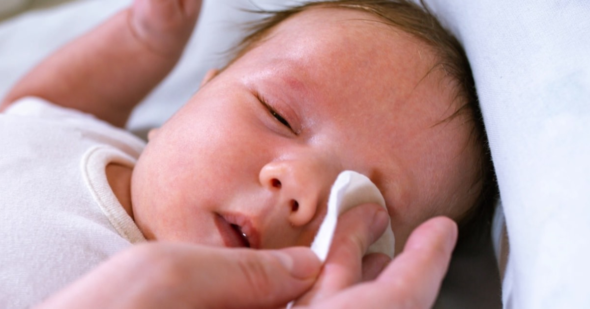 Conjuntivitis Del Reci N Nacido Causas S Ntomas Y Tratamiento