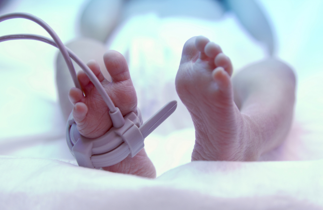 Pies de un recién nacido con luz ultravioleta en una incubadora