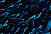 Se trata de una prueba en la que se analiza el tamaño y la forma que poseen los espermatozoides, convirtiéndose así en un factor más que puede influir o contribuir a la fertilidad masculina.