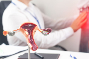 La ovariectomía consiste en la extirpación de uno o ambos ovarios. Suele realizarse en caso de quistes o sospecha de infección o cáncer. ¿Qué implica, cómo y por qué se hace?