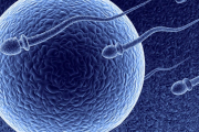 Dentro de las distintas causas de infertilidad en el hombre, la teratozoospermia suele ser otro de los factores que tiende a influir en la imposibilidad de conseguir el embarazo, caracterizándose por una presencia elevada de espermatozoides de forma anómala.