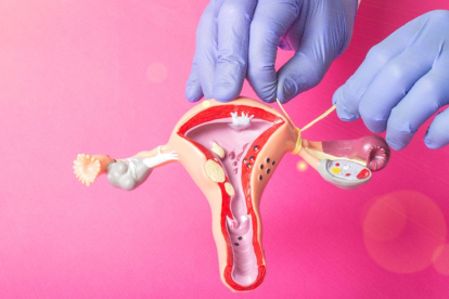 ¿Es posible el embarazo después de una ligadura de trompas? ¿Es posible la reversión de este procedimiento quirúrgico?