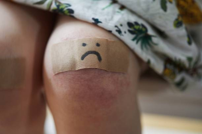 Toddler girl with a plaster on her grazed knee with a sad face drawn on i