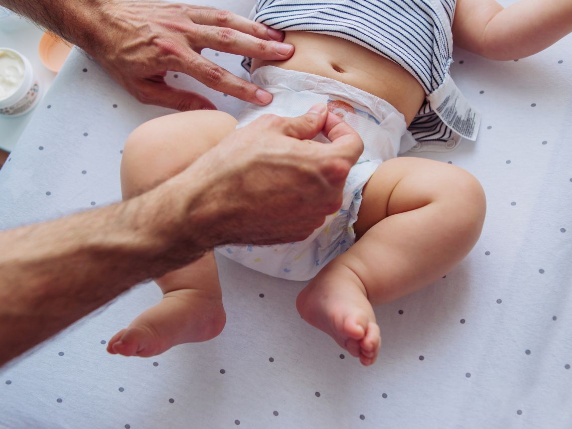 Mi bebé tiene el culete rojo: la dermatitis del pañal